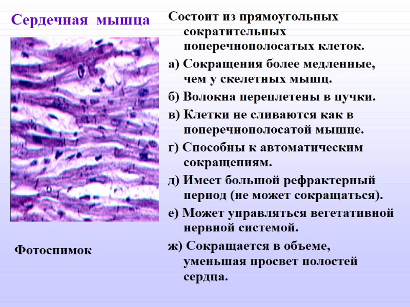 Сердечная  мышца Состоит из прямоугольных сократительных поперечнополосатых клеток. а) Сокращения более медленные, чем